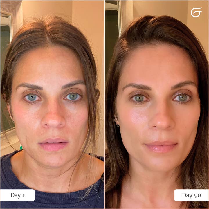 LED Light Therapy Face Mask