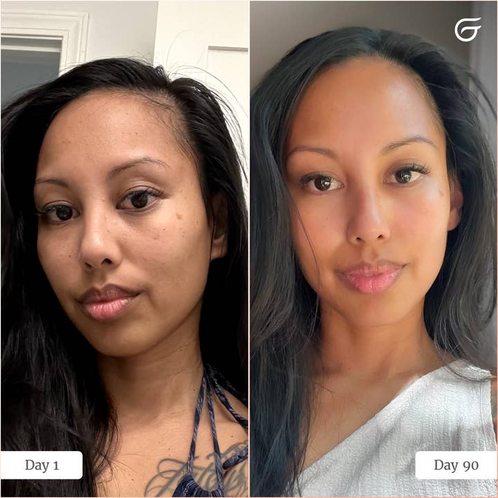 LED Light Therapy Face Mask